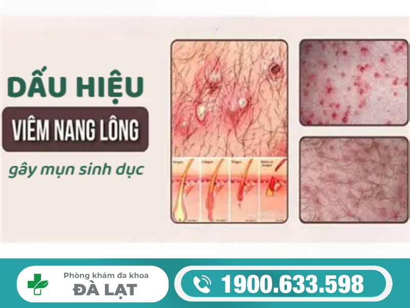 Hình ảnh minh họa